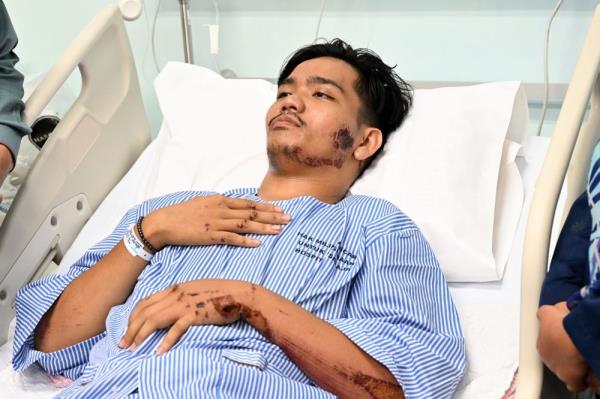 UiTM student injured in Dungun crash set for discharge following crash that killed three friends, counselling to follow
